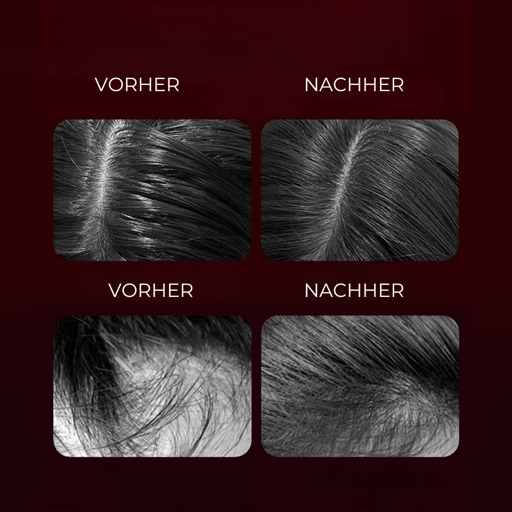 Anti Loss Haar & Kopfhaut-Booster