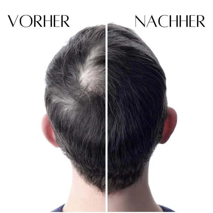 Anti Loss Haar & Kopfhaut-Booster